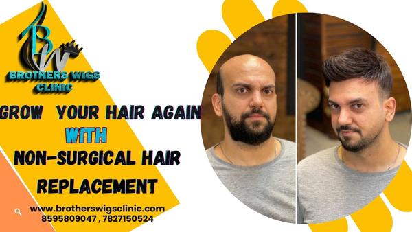 hair loss