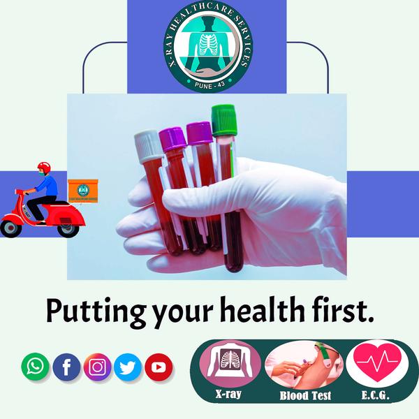 home diagnostic and lab tests