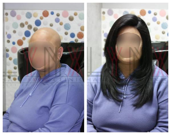 Cancer patients usually have to go throu