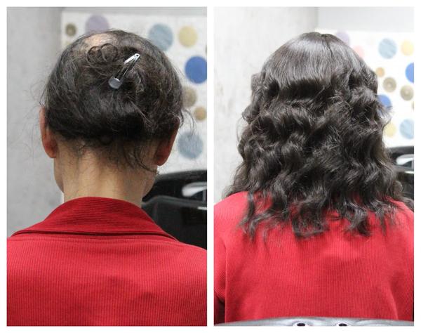 Chemo Wigs in Gurgaon: 
Going through ch