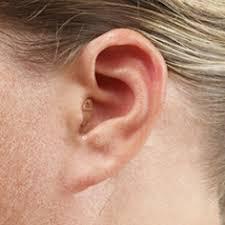 best hearing aid dealer nungam