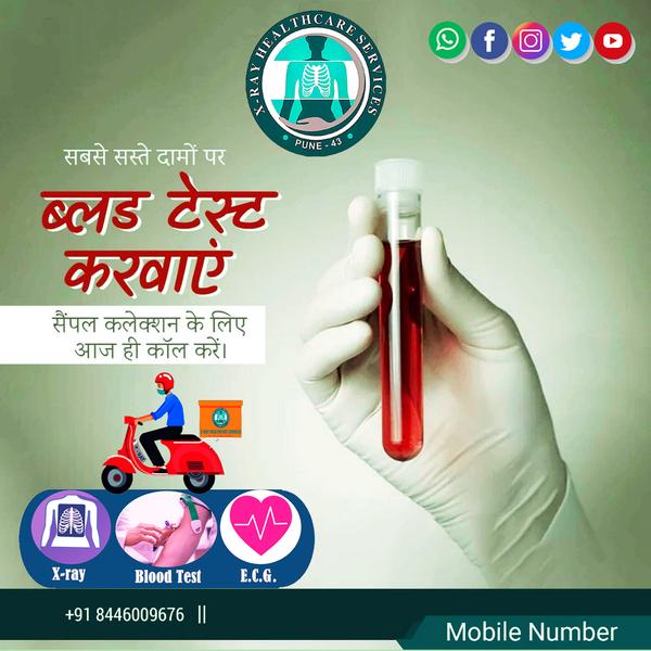 home diagnostic and lab tests