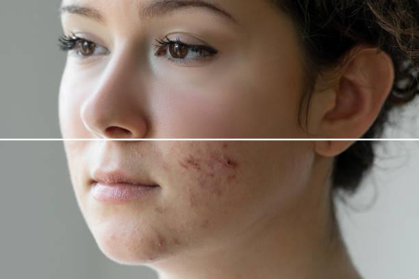 skin smooth