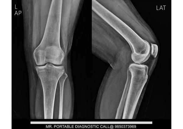 knee ap lat view