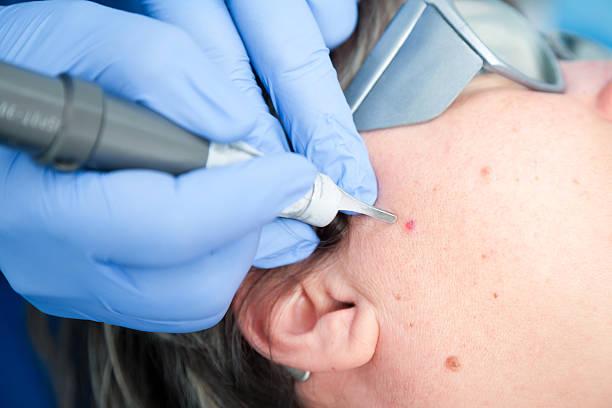 microblading needs