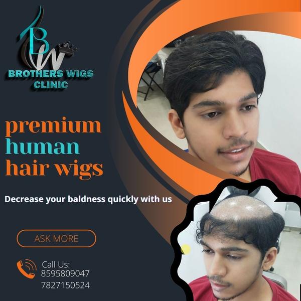 natural looking hair patch for