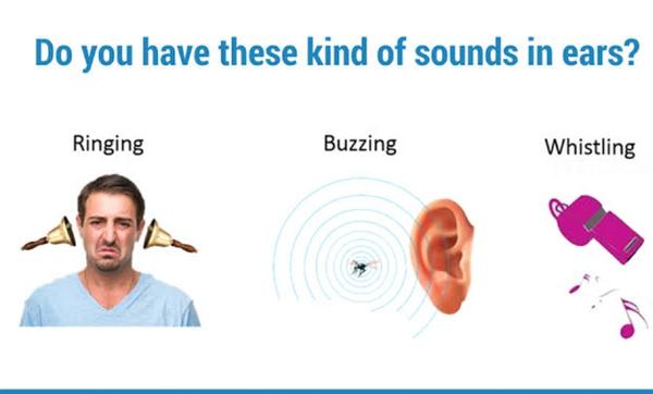 tinnitus therapy
