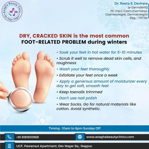 in winter care ur foots with best treatm