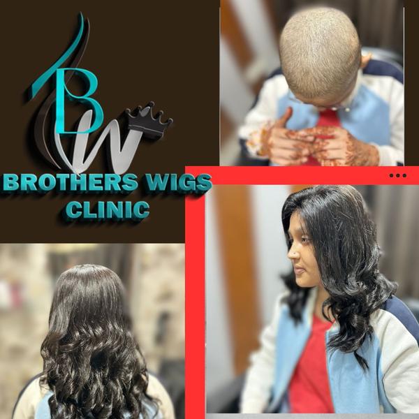 subhash nagar hair patch