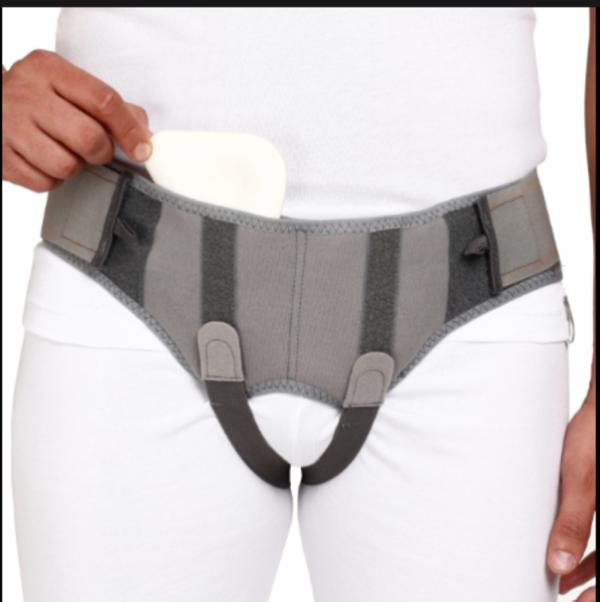 inguinal hernia