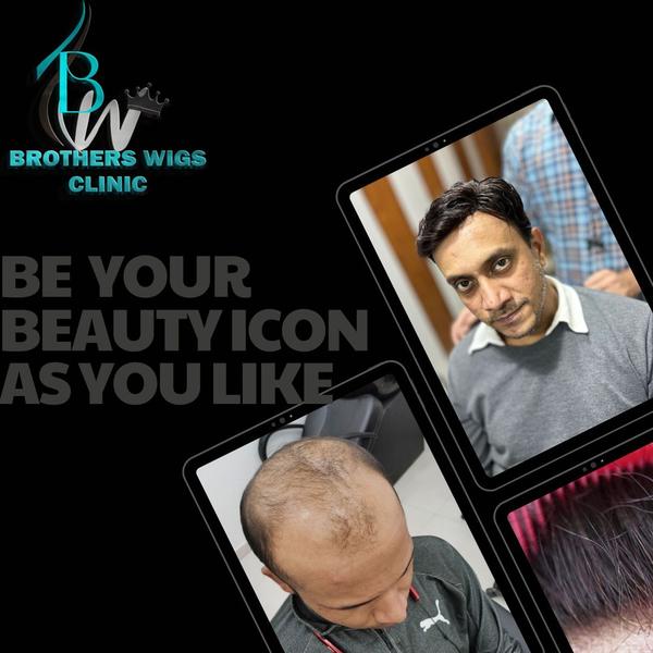 best hair patch service