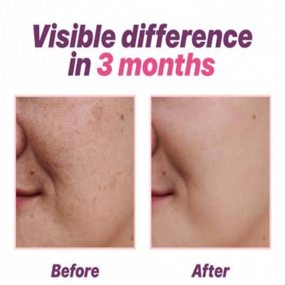 refreshed appearance