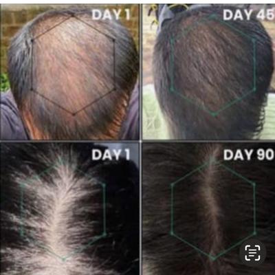 thicker stronger hair