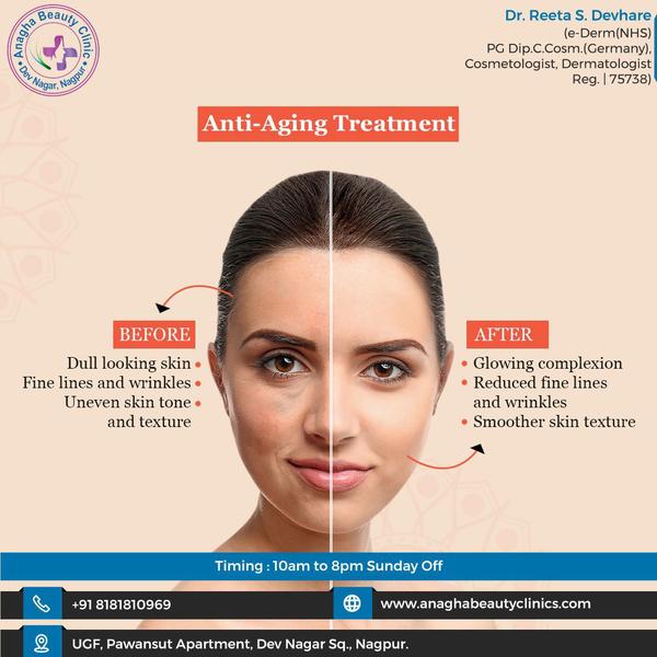 have u worried about Anti rinkles, 
do W