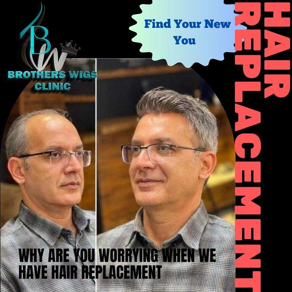 men s hair patches karol bagh