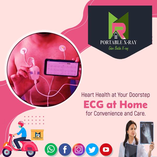 portable ecg