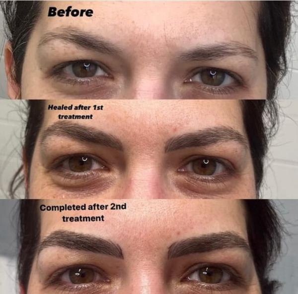 Microblading is a tattooing technique wh