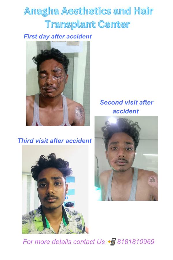 make to change urself with best treatmen