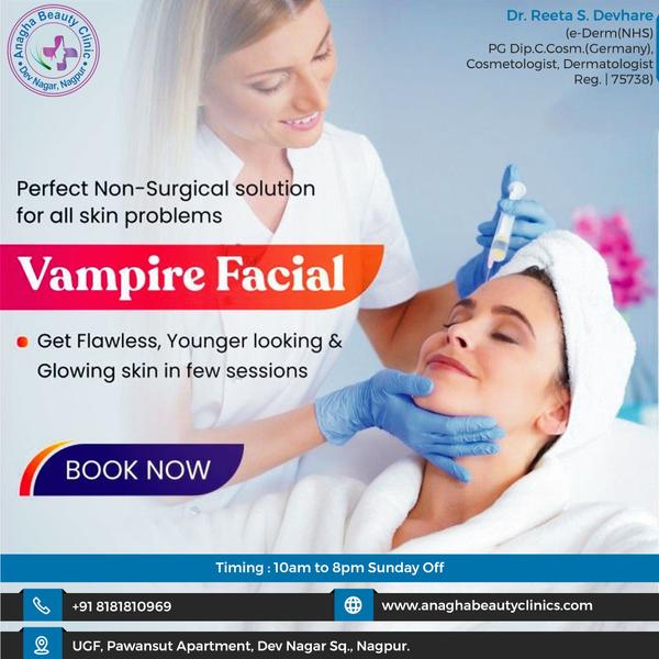 What is a vampire facial?

➡️A vampire f