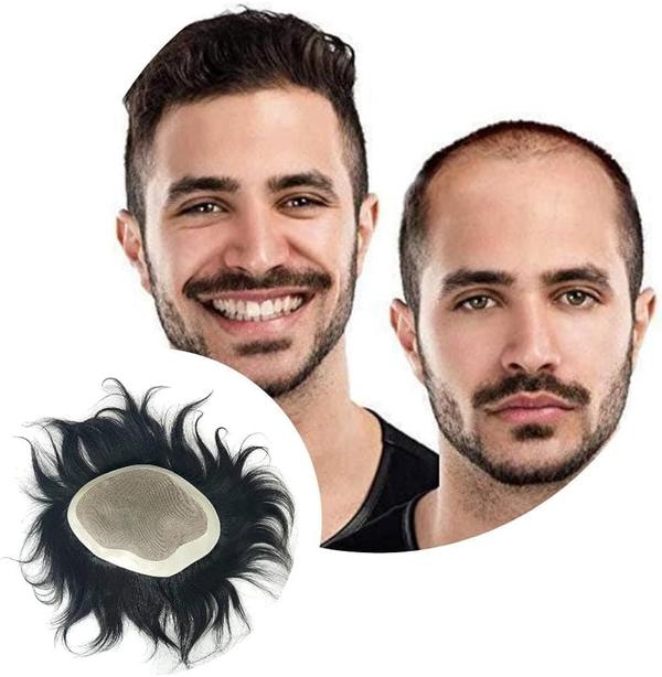 Non-surgical hair replacement offers sev