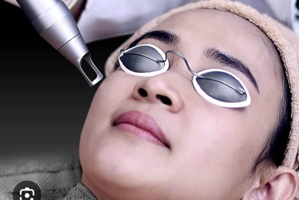 Pico Laser treatment uses a specialised 