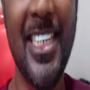 admission procedures