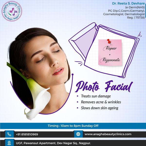 photo facial is very effective treatment