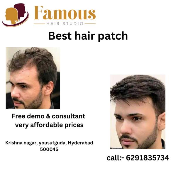 qualities patches