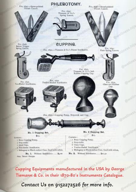 History of Hijama (Cupping Therapy) Hija
