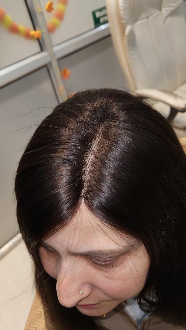 Wigs for Cancer Patients in Badlapur
Lyn