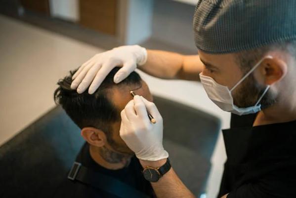 Non-Surgical Hair Transplant Solutions i