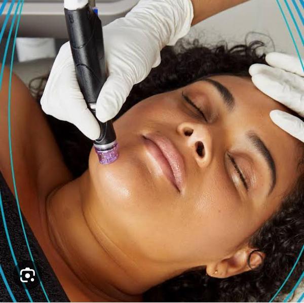 All hydrafacials wrk in these three step