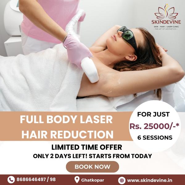 Laser hair removal can be performed on a
