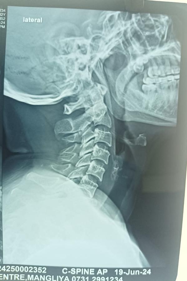 ACCIDENTAL TRAUMA TREATMENT IN