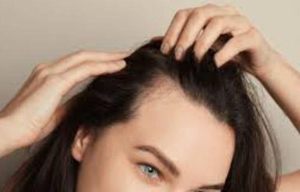 Non-Surgical Hair Transplant in Chennai