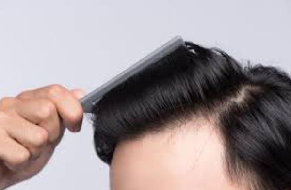 Non-Invasive Hair Restoration in Chennai