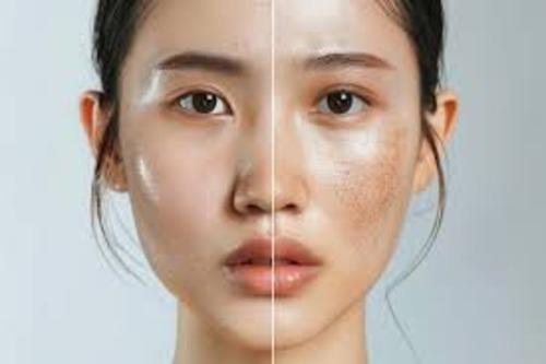 basic hydrafacials