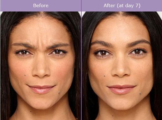 services hydrafacial