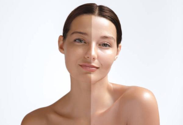 ultimate skin transformation