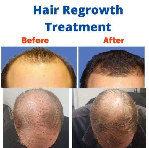 update image