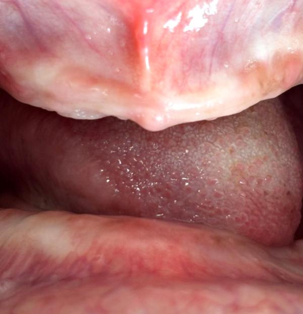 update image