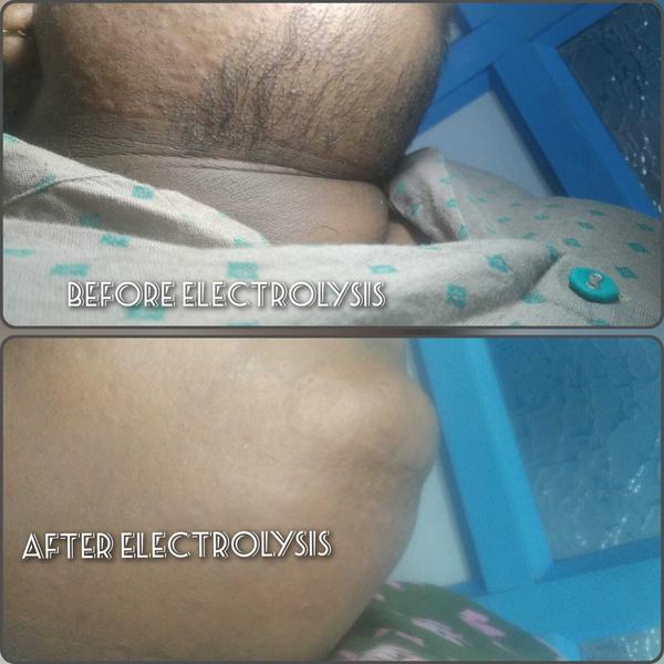 Say Goodbye to Unwanted Hair. 