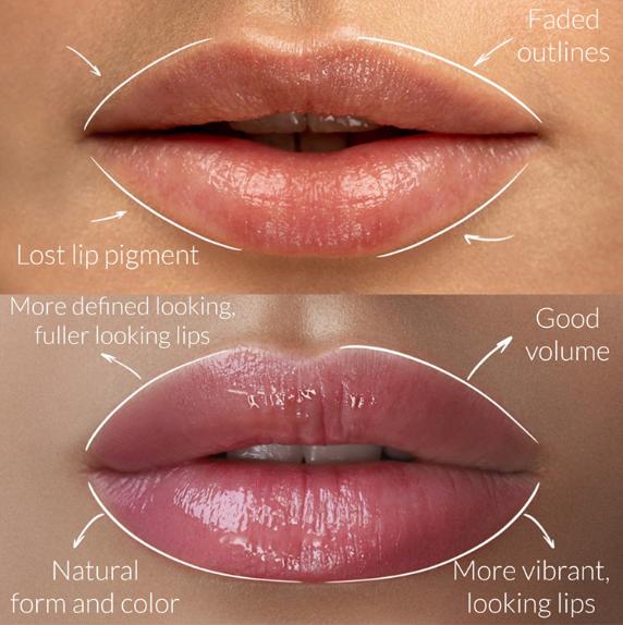 lips