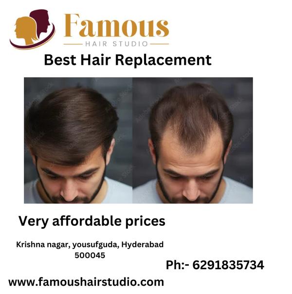 hair wig in Hyderabad 
 best q