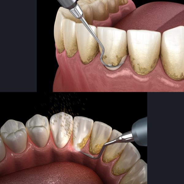 update image