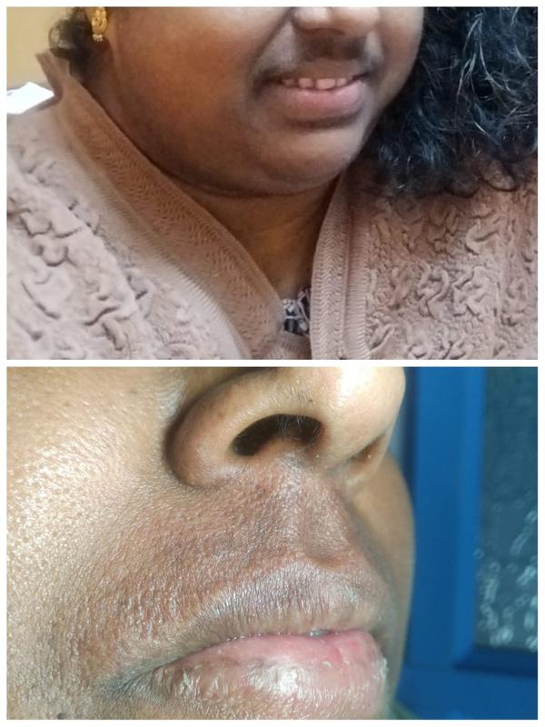 Enhance Your Appearance with P