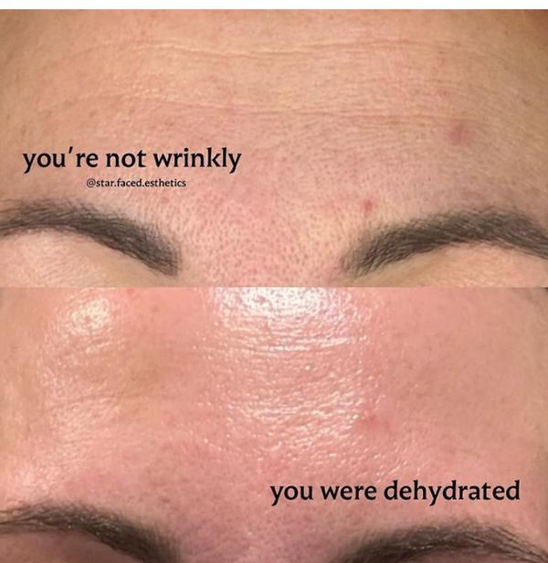 Get younger -looking skin -wrinkle free 