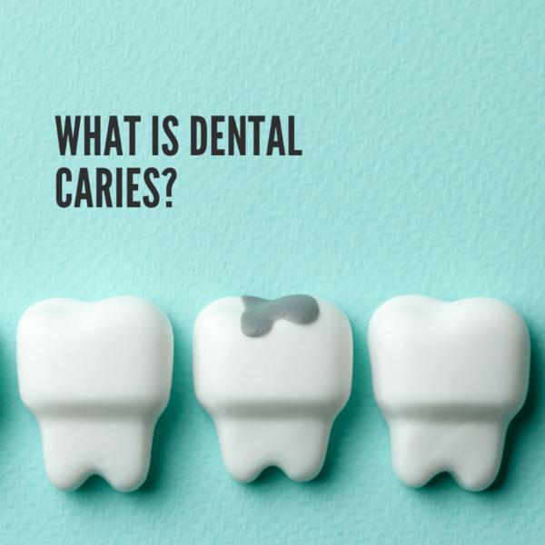 dental sealants