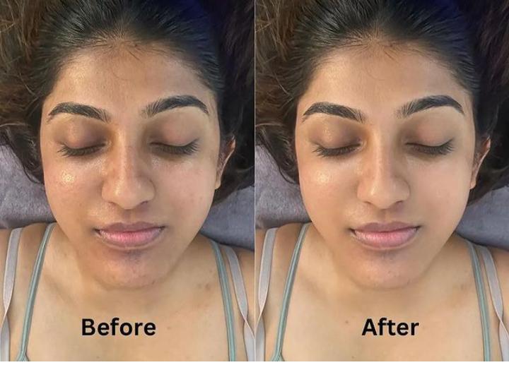      Anagha Aesthetics and Hair Transpla