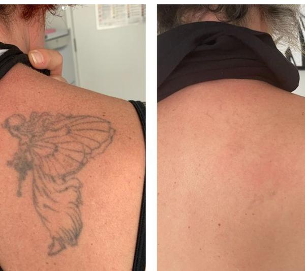 🏥💥💥Anagha Aesthetics and Hair Transpl